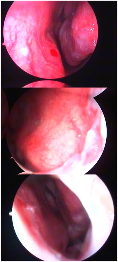 Frontiers | LESS-Net: a lightweight network for epistaxis image ...