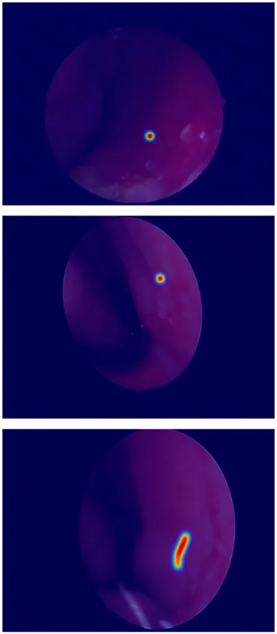 Frontiers | LESS-Net: a lightweight network for epistaxis image ...