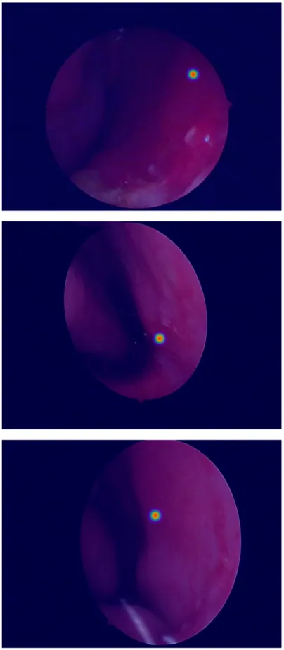 Frontiers | LESS-Net: a lightweight network for epistaxis image ...