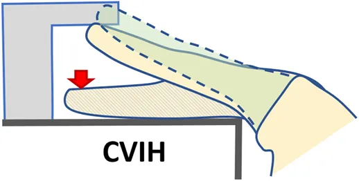 Frontiers | Changing Finger Movement Perception: Influence of Active ...