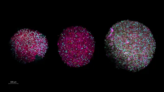 Photo of a brain organoids at 4, 8, and 14 weeks old with different brain cell types stained in different colors