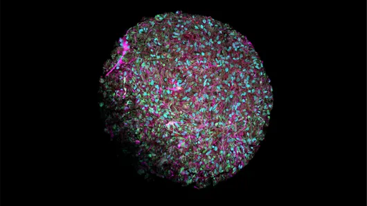 Photo of a brain organoid at 14 weeks old with different brain cell types stained in different colors