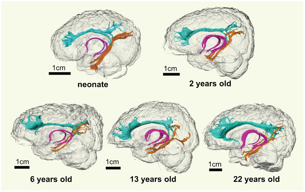 Frontiers Microstructure Length And Connection Of Limbic Tracts In