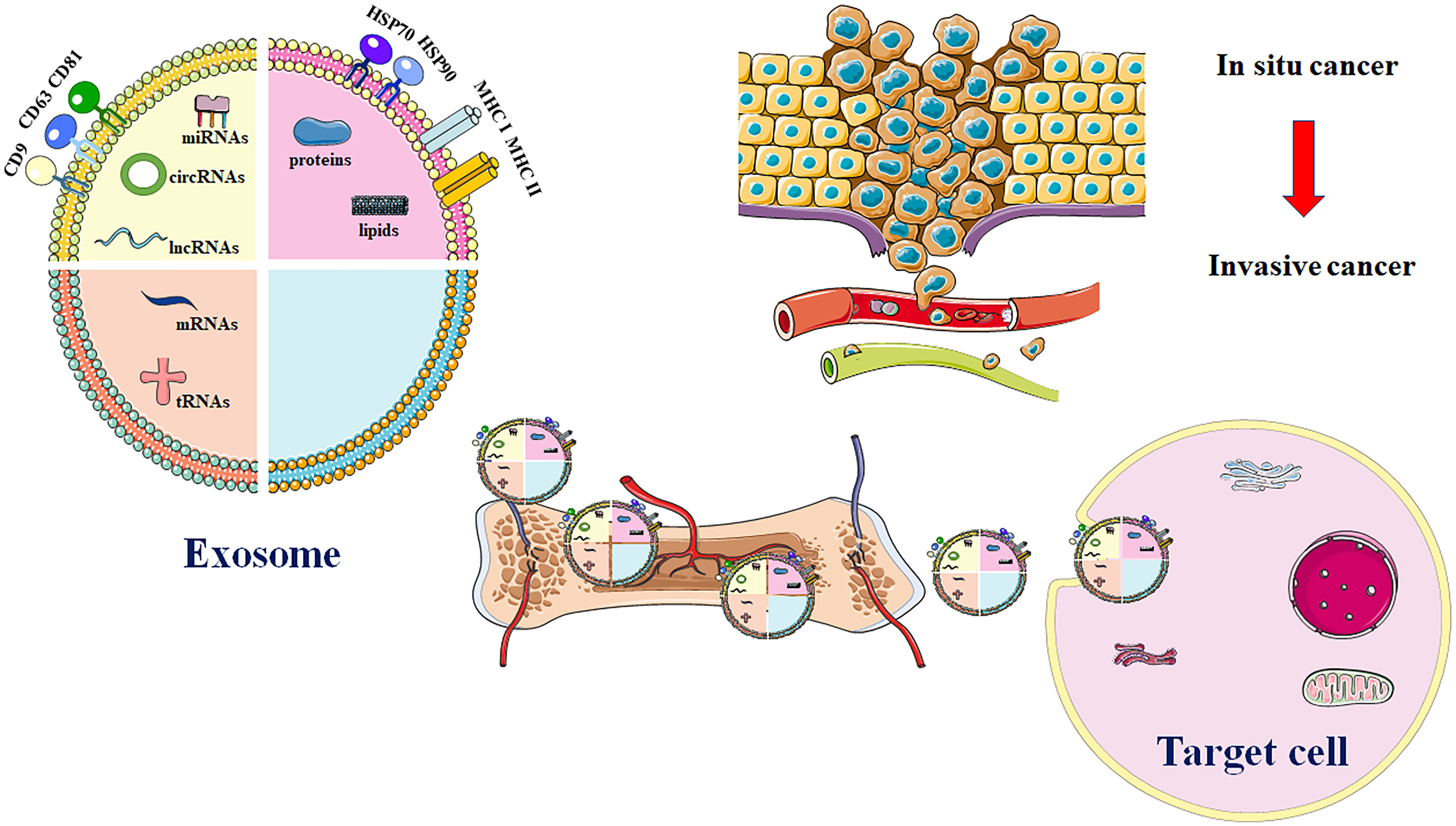 miR-130a and Tgfβ Content in Extracellular Vesicles Derived from