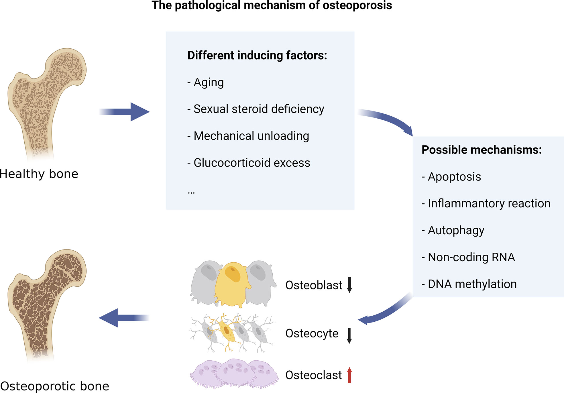 exercise for osteoporosis a literature review of pathology and mechanism