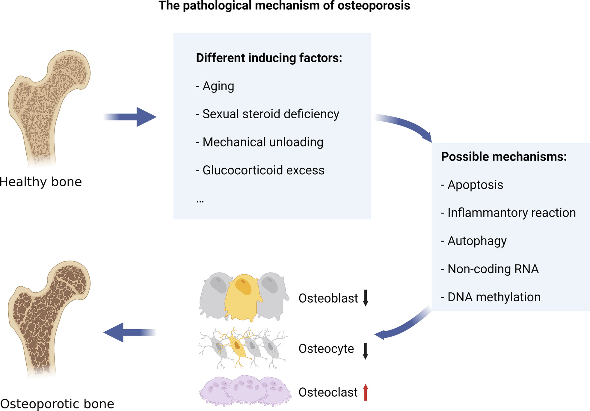 Que alimentos son buenos para la osteoporosis