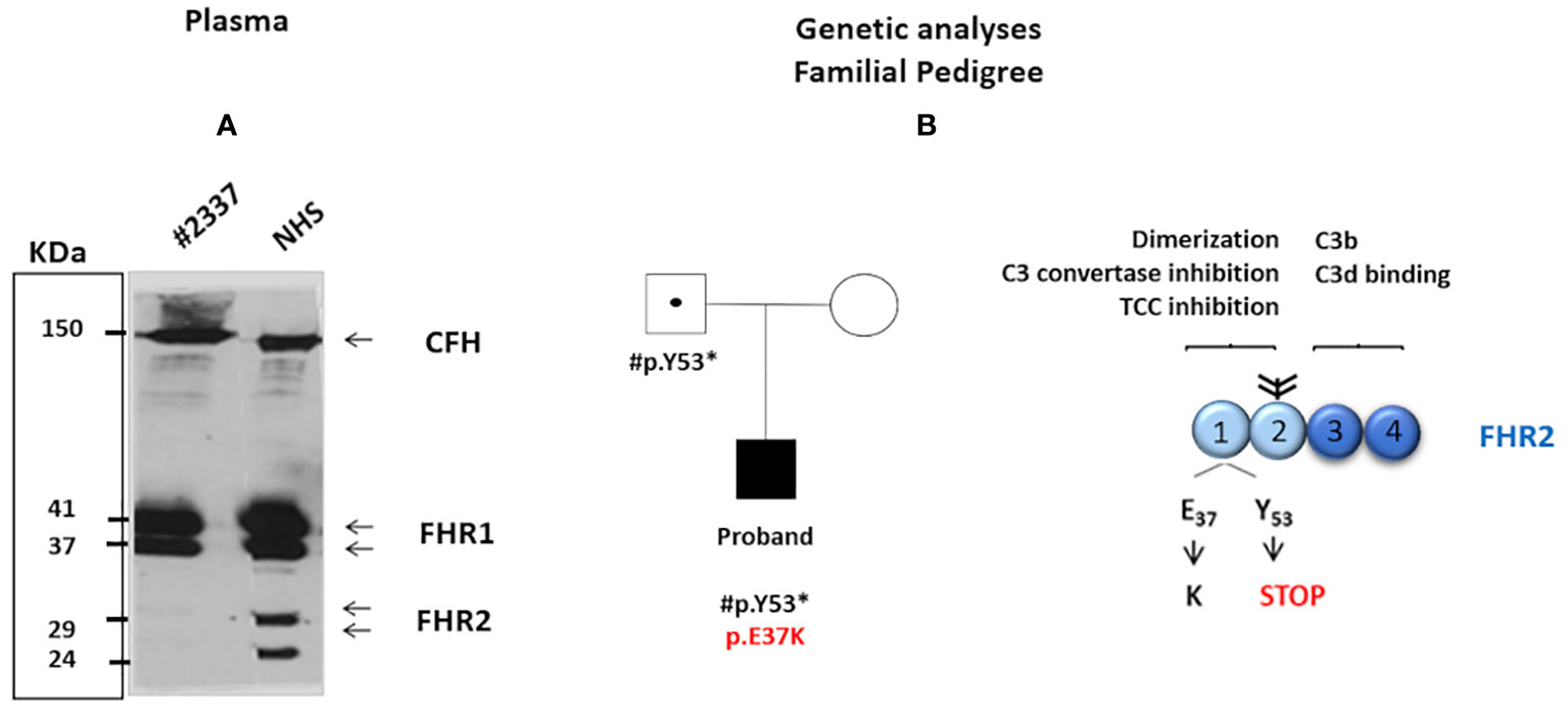 Frontiers  Case report: Short-term eculizumab use in atypical HUS