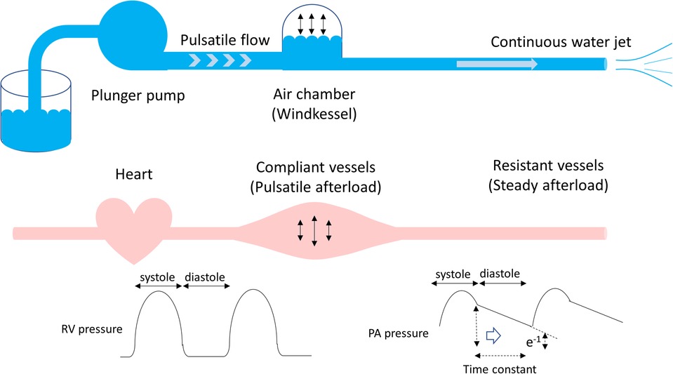 Braz J Cardiovasc Surg - The pulmonary vascular blood supply in the  pulmonary atresia with ventricular septal defect and its implications in  surgical treatment