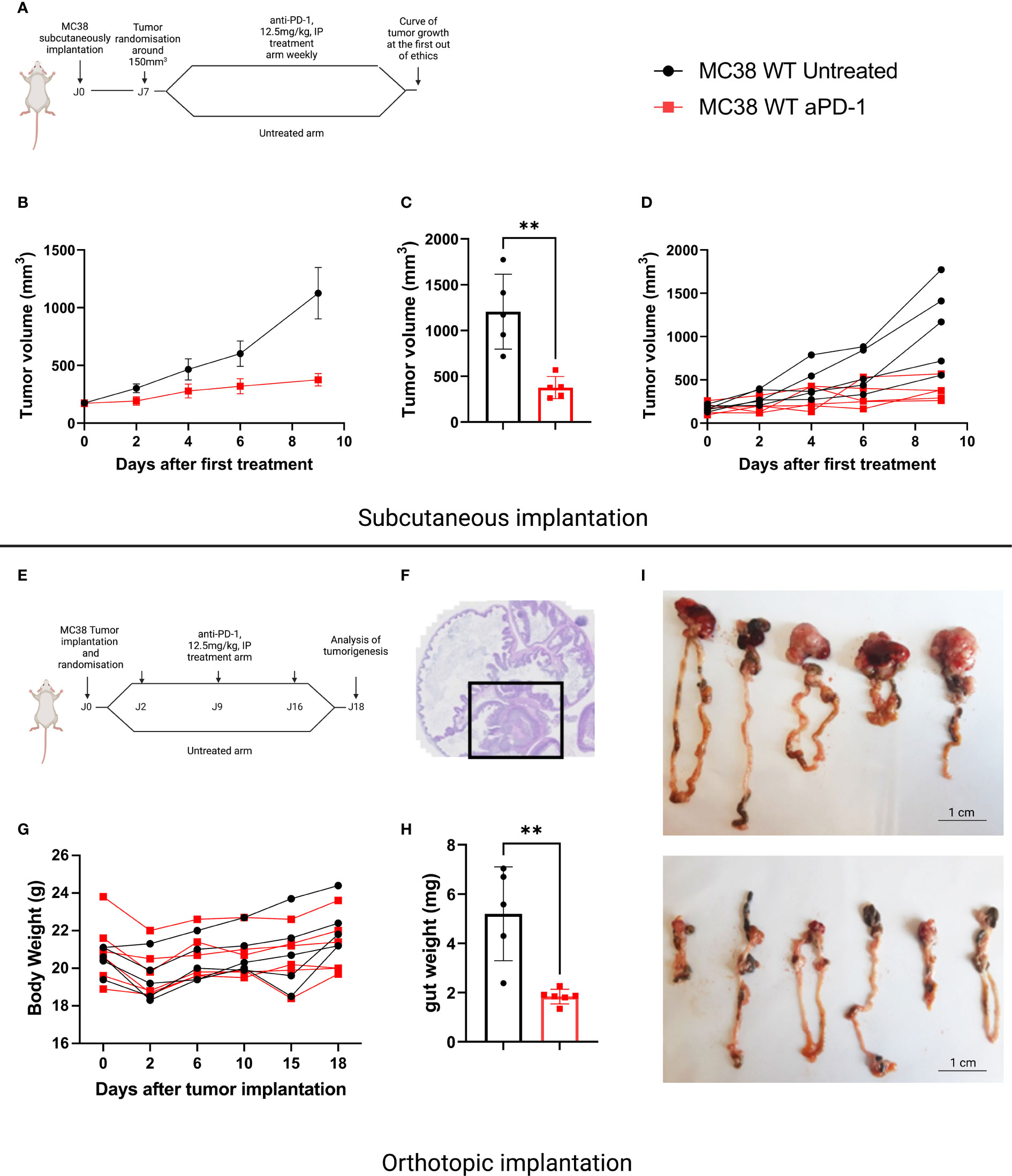 Gut Microbiota Influenced The Xenograft MC38 Tumor Growth 57 OFF