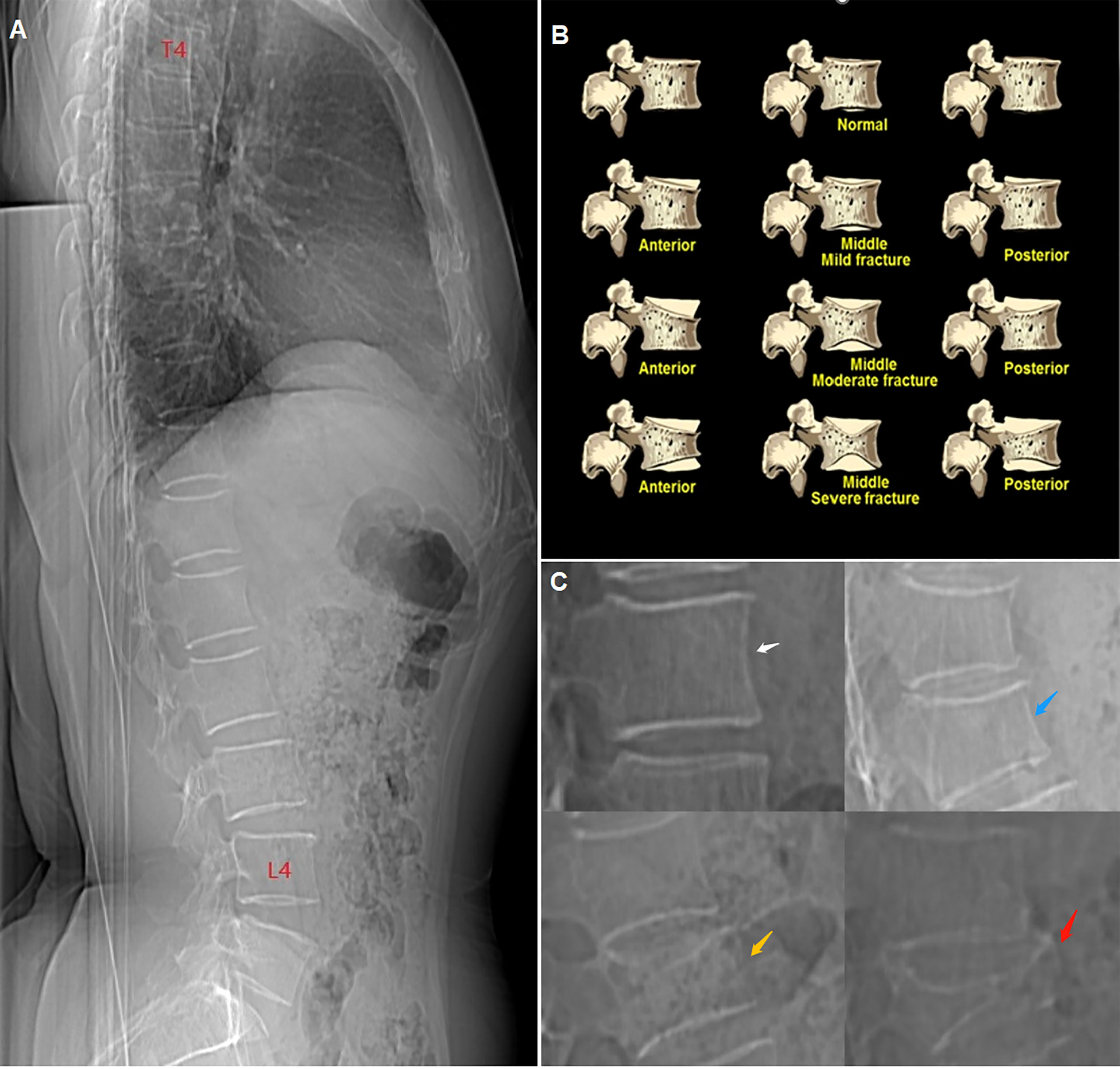 The X-ray scanner is used to investigate a discrepancy in sex