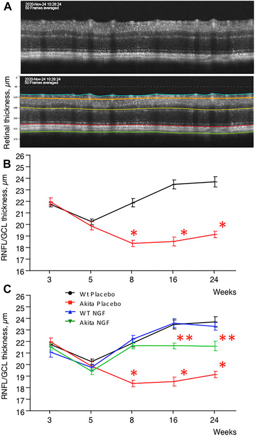 Optical Coherence Tomography: Imaging Mouse Retinal Ganglion Cells