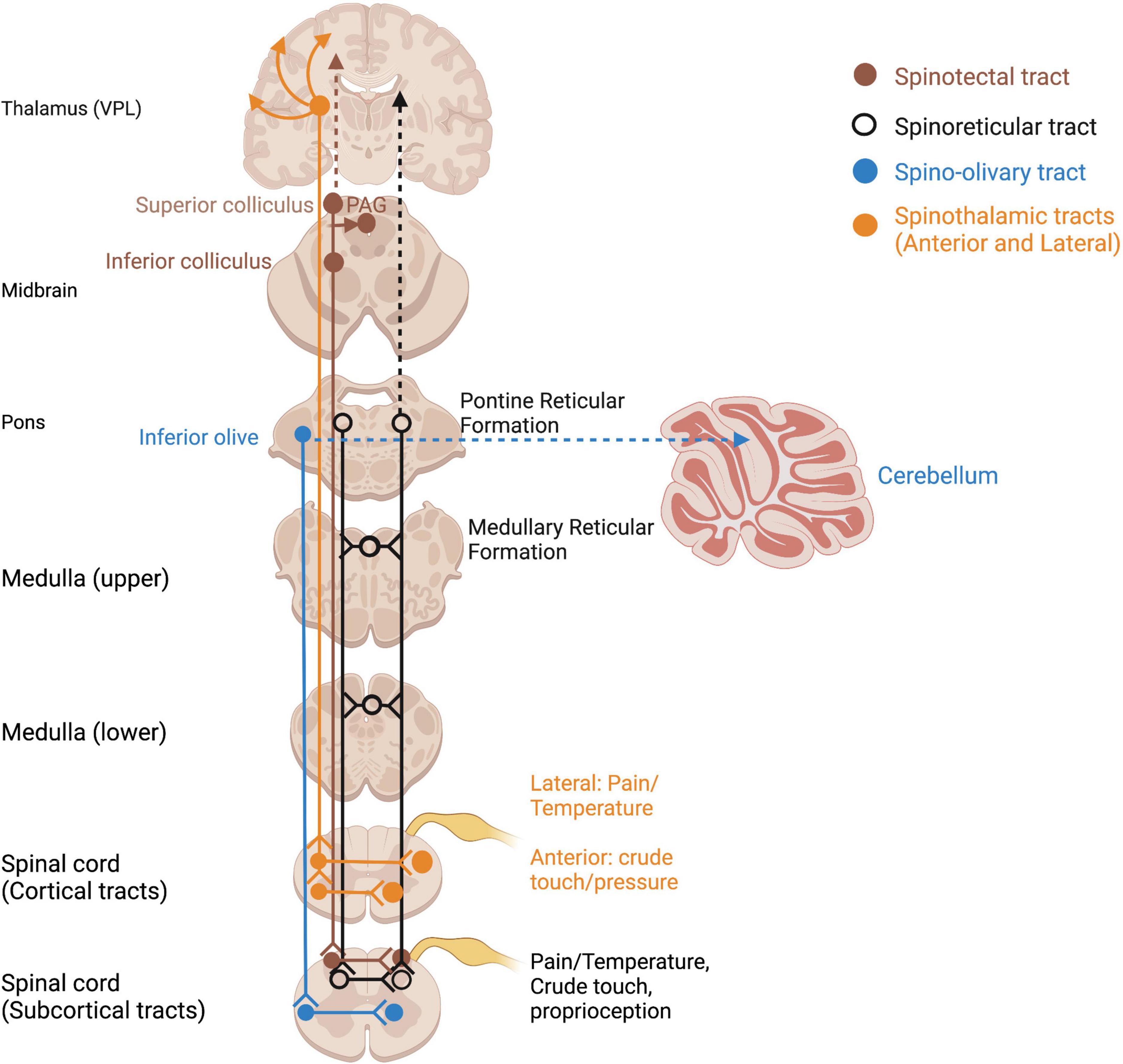 Frontiers  The brain-body disconnect: A somatic sensory basis for  trauma-related disorders