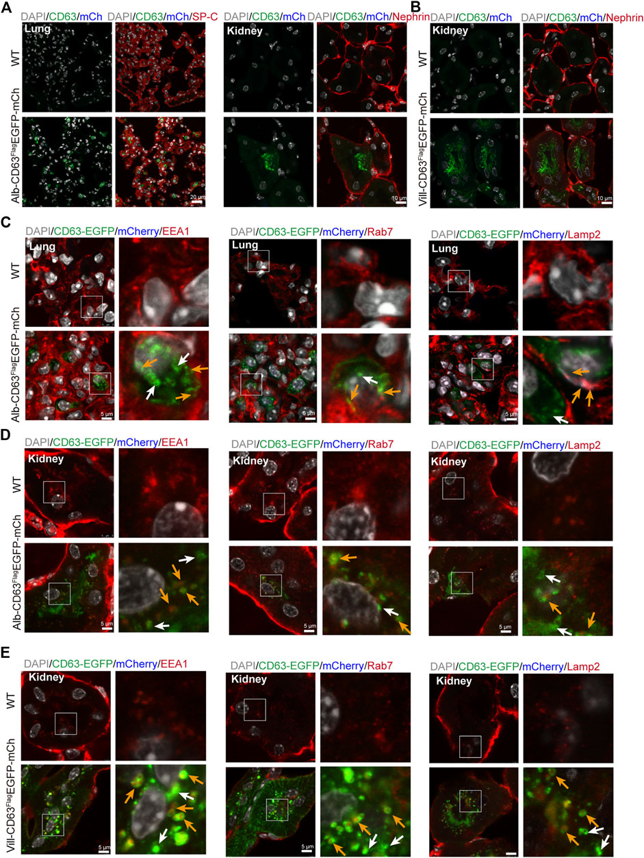 In Vivo Real-Time Imaging of Extracellular Vesicles in Liver