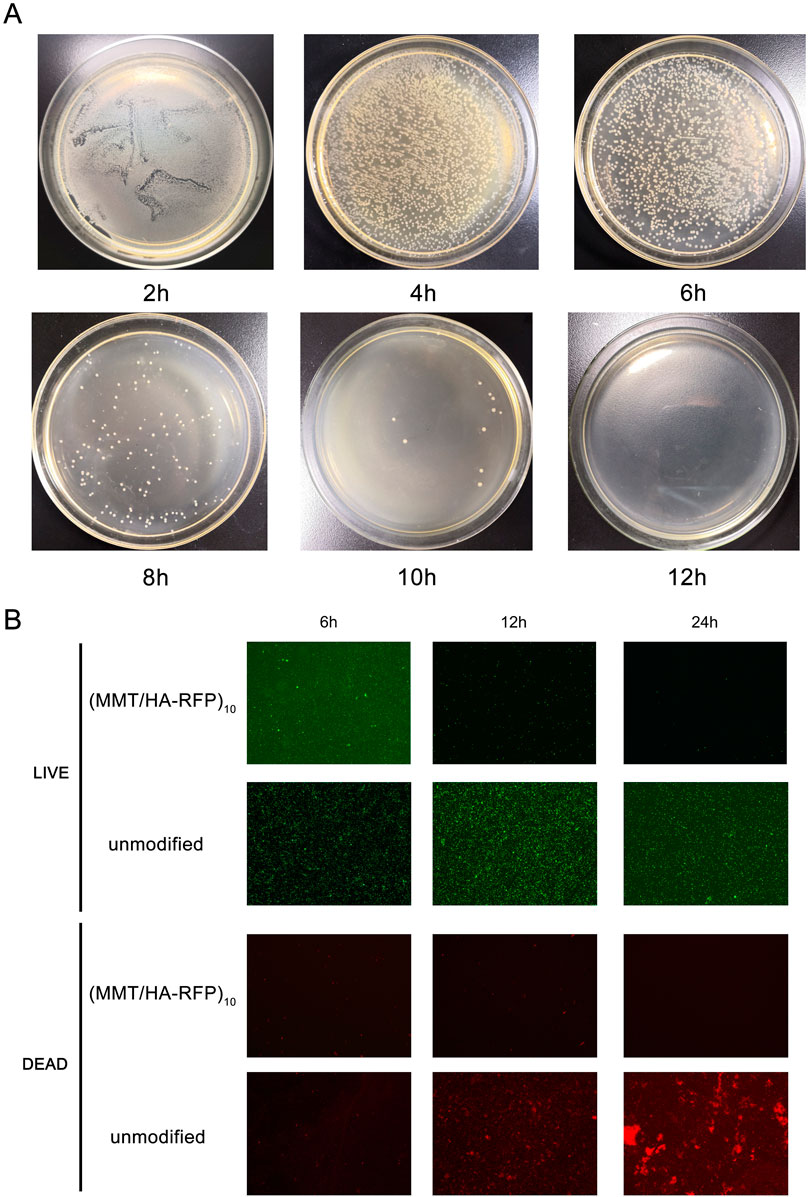 Frontiers  Antibacterial intraosseous implant surface coating