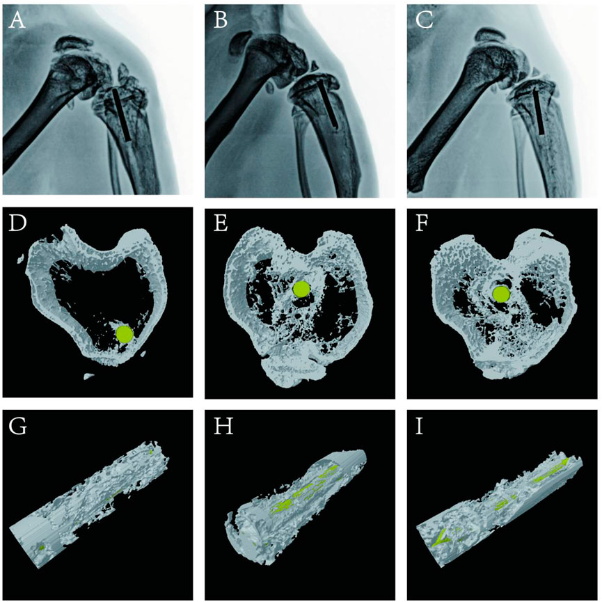 Frontiers  Antibacterial intraosseous implant surface coating that  responds to changes in the bacterial microenvironment