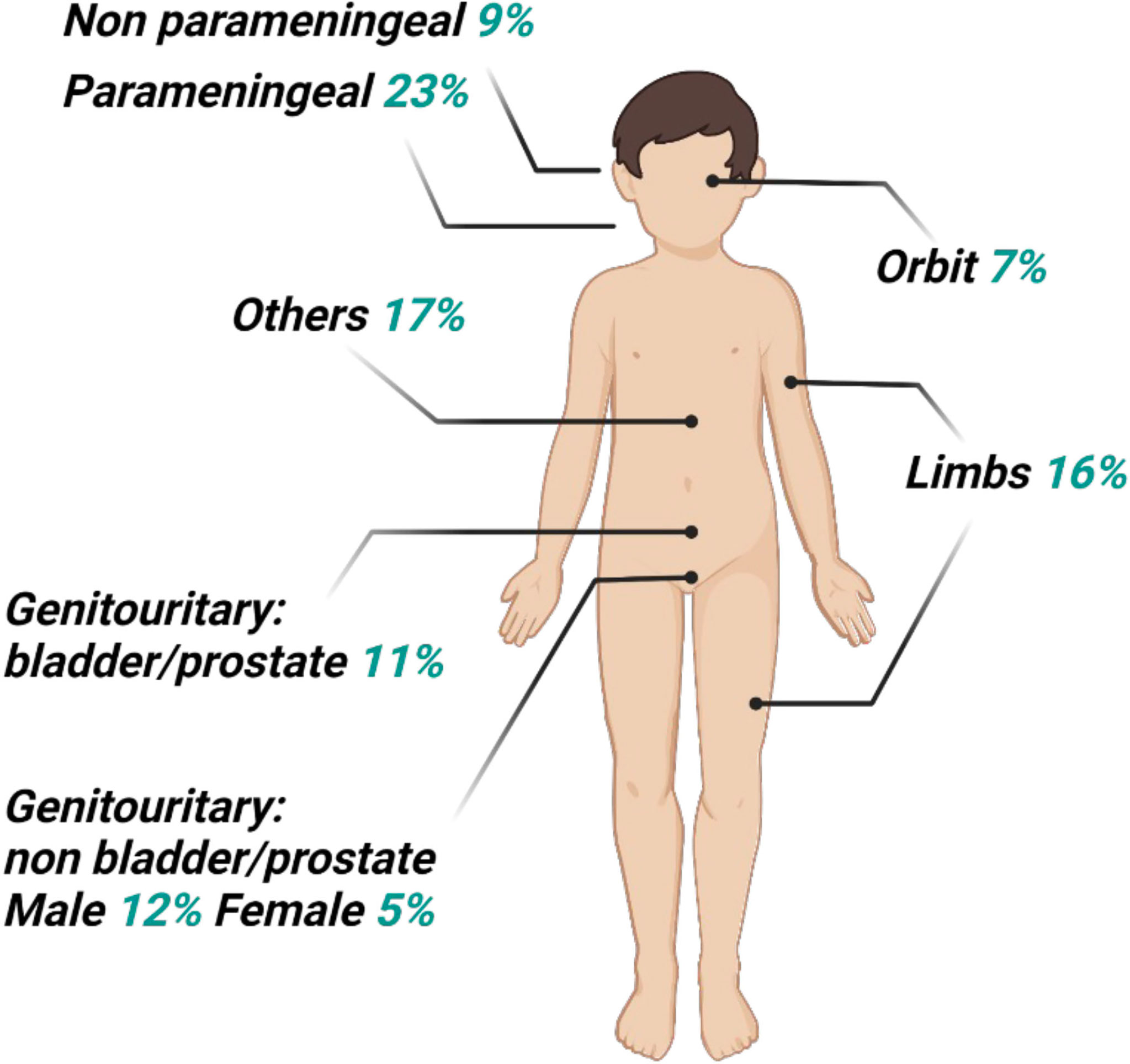 Frontiers | Radioresistance in rhabdomyosarcomas: Much more than a