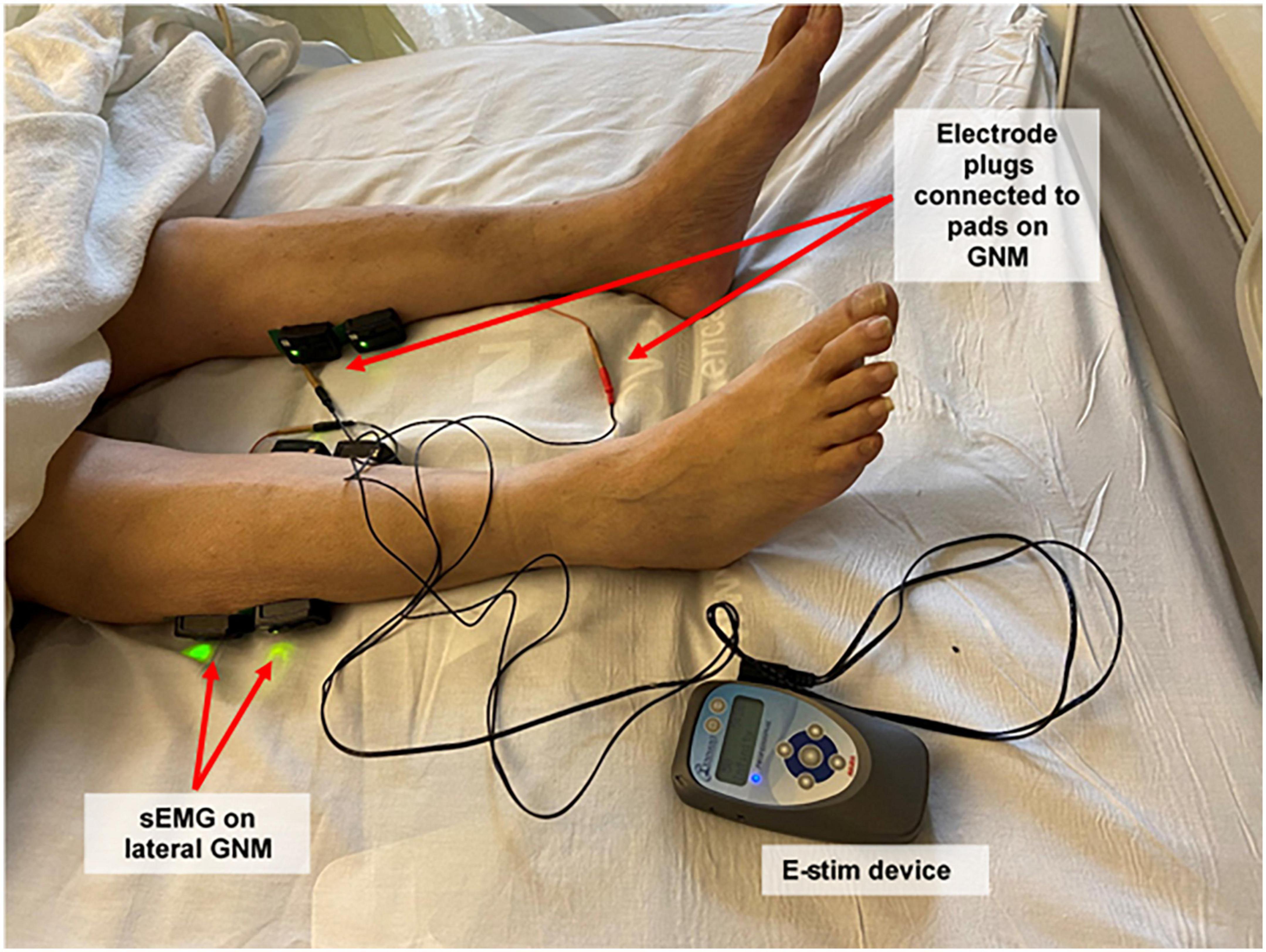 Frontiers  Safety and efficacy of electrical stimulation for  lower-extremity muscle weakness in intensive care unit 2019 Novel  Coronavirus patients: A phase I double-blinded randomized controlled trial