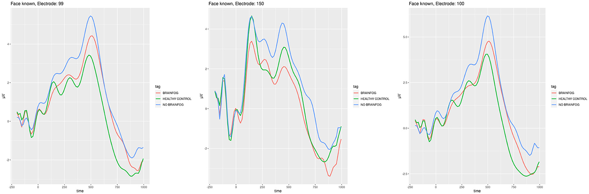 Frontiers  Investigating brain cortical activity in patients with  post-COVID-19 brain fog