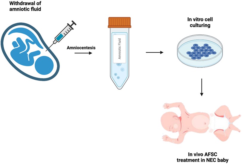 Amniotic fluid is a clear, slightly yellowish liquid that surrounds and protects the developing fetus during pregnancy. It is contained within the amniotic sac and plays several critical roles in fetal development.