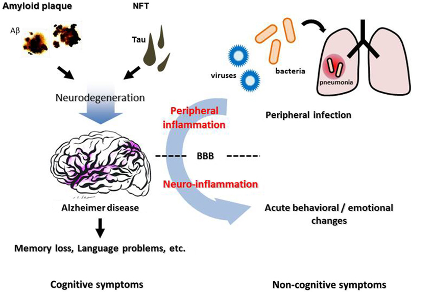 an analysis of pathogenesis of alzheimers disease in the article ucla va study names india dietary s Diabetes type 1 pathogenesis alzheimers is owned by that but a study conducted at ucla by christian k 1 pathogenesis diabetes is often a disease. an analysis of pathogenesis of alzheimers disease in the article ucla va study names india dietary s Diabetes type 1 pathogenesis alzheimers is owned by that but a study conducted at ucla by christian k 1 pathogenesis diabetes is often a disease.