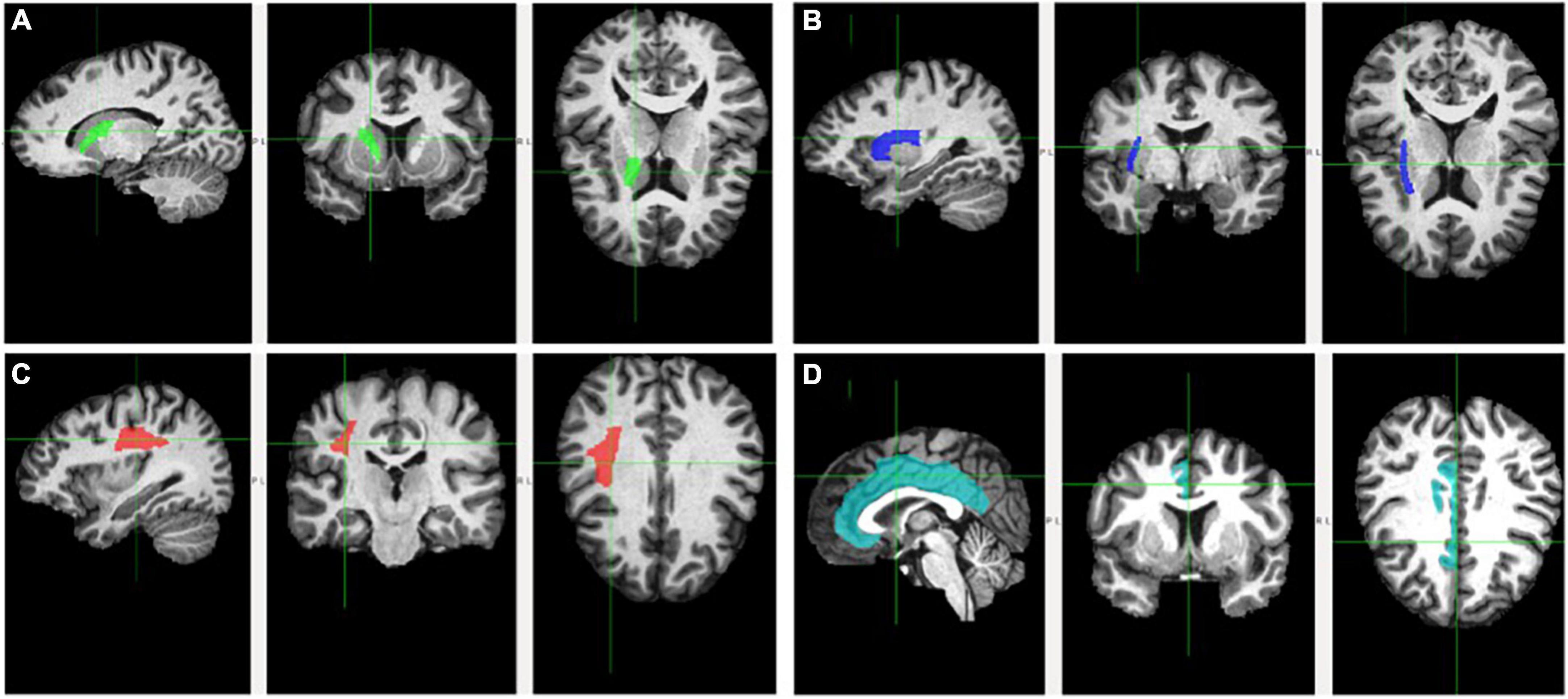 Brain-machine interface (BMI) details – Dr Alan D. Thompson – Life Architect