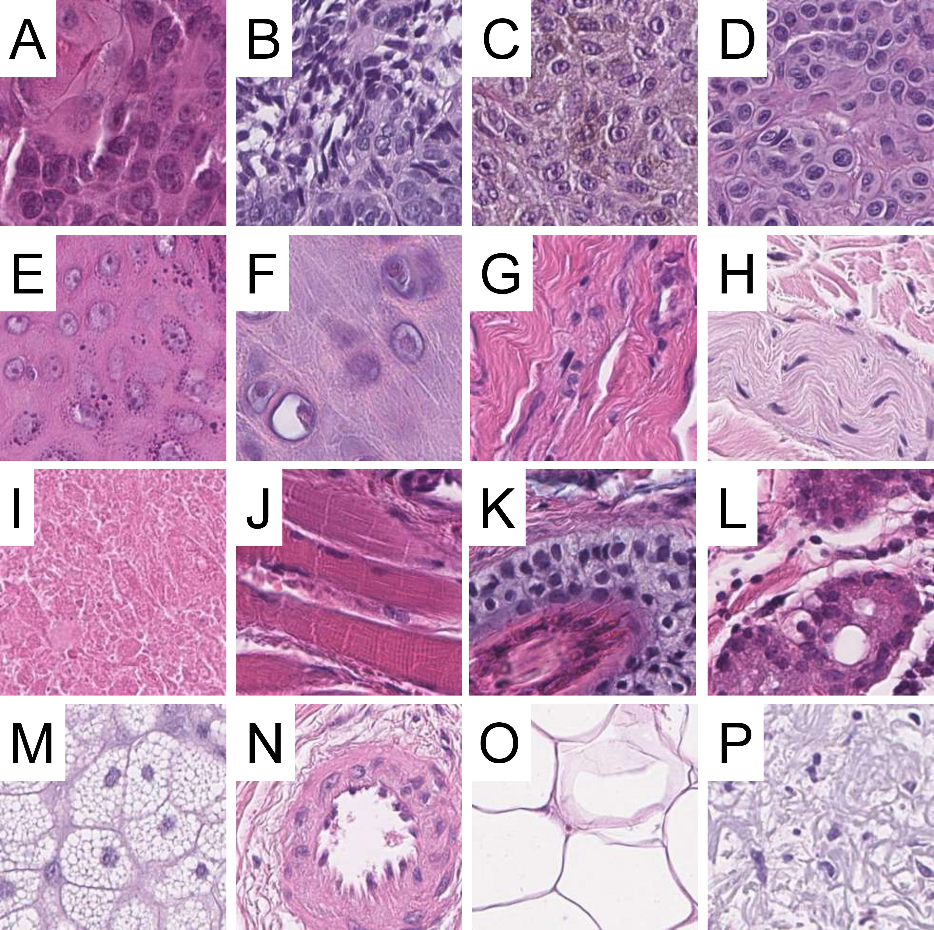 File:Normal breast histology.png - Wikipedia