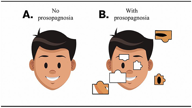 Figure 2 - (A) People without prosopagnosia can put the pieces of faces together and recognize familiar faces.