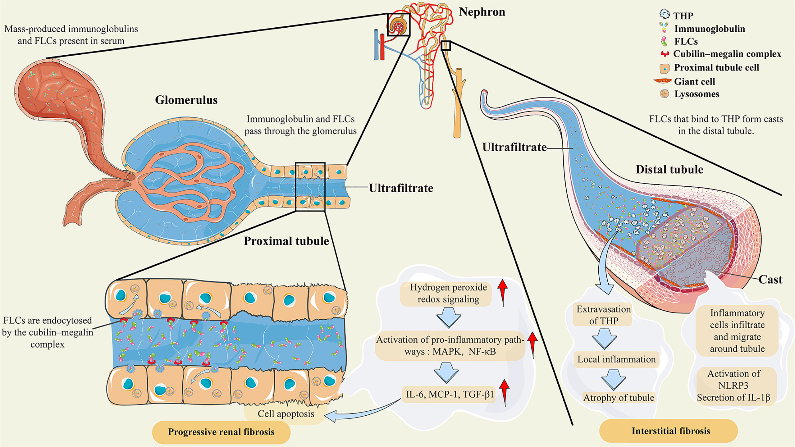 Frontiers | High-cutoff hemodialysis multiple myeloma patients with kidney injury