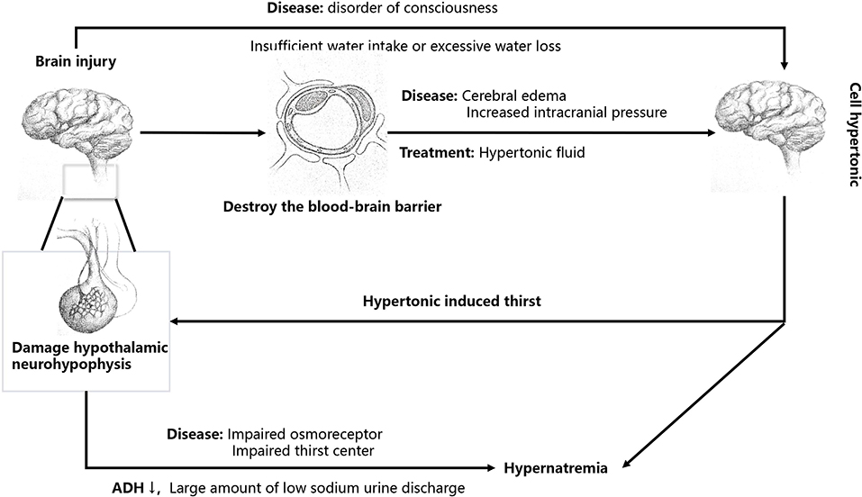 Frontiers Diagnosis And Treatment Of Brain Injury Complicated By 