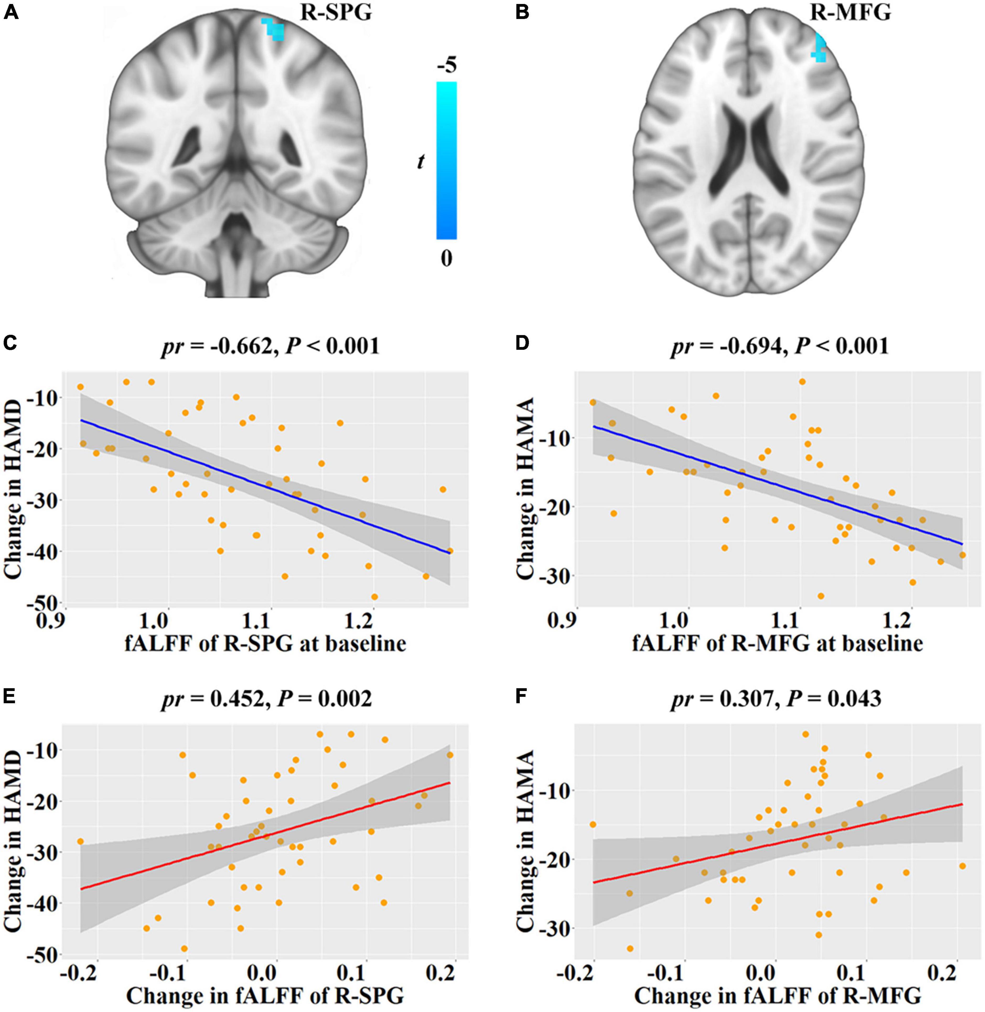 Frontiers  Neural activity in adults with major depressive disorder  differs from that in healthy individuals: A resting-state functional  magnetic resonance imaging study