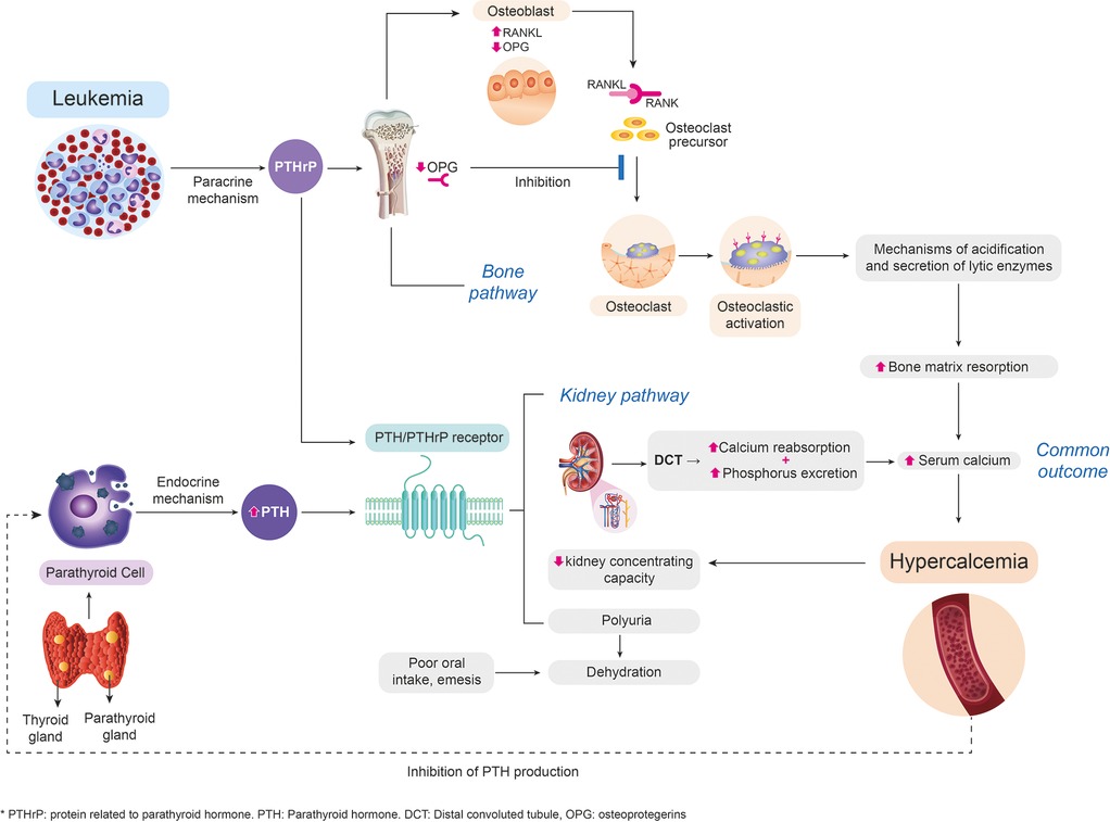 frontiers-malignant-hypercalcemia-as-the-debut-of-acute-lymphoblastic