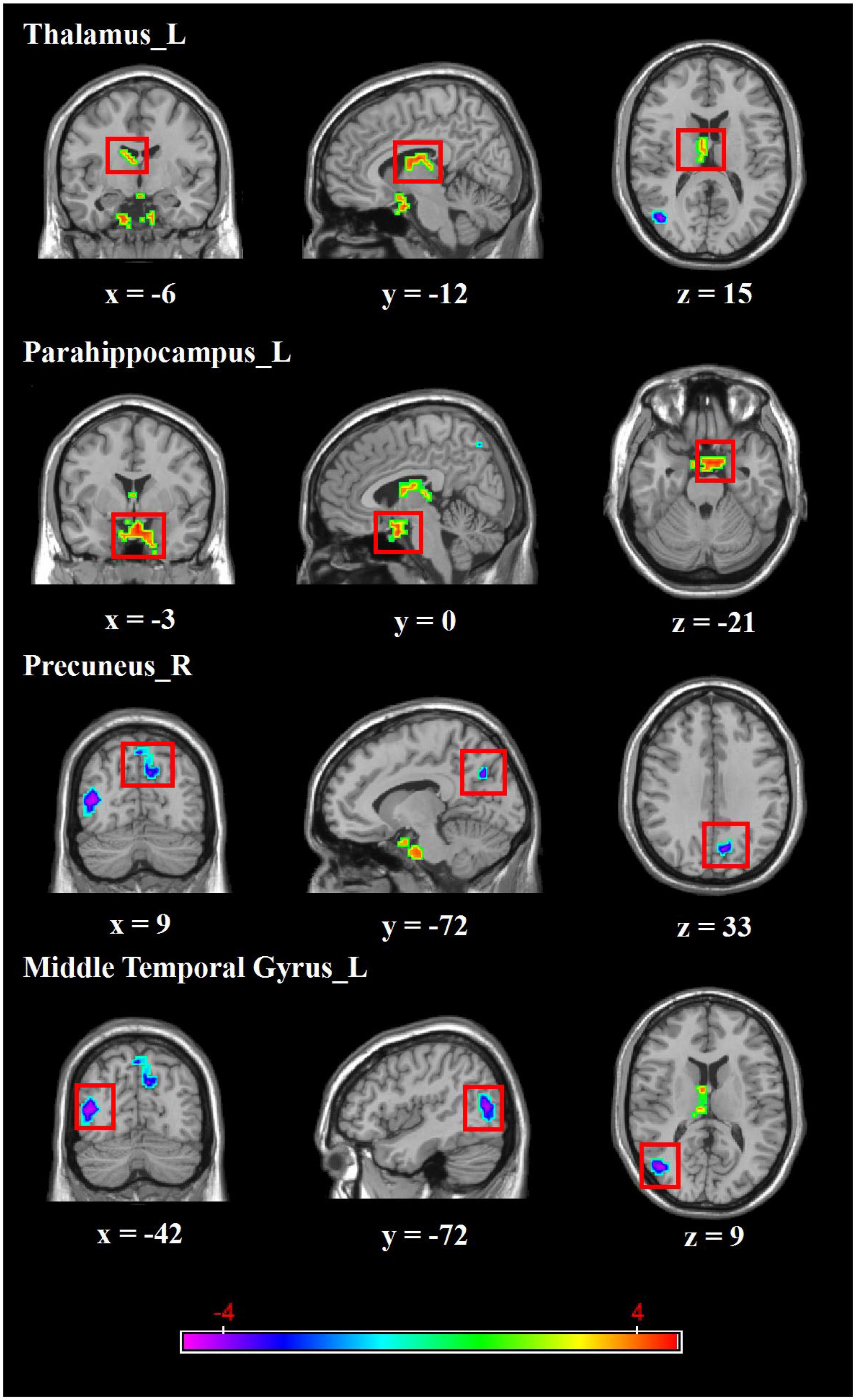 Frontiers  Neural activity in adults with major depressive disorder  differs from that in healthy individuals: A resting-state functional  magnetic resonance imaging study