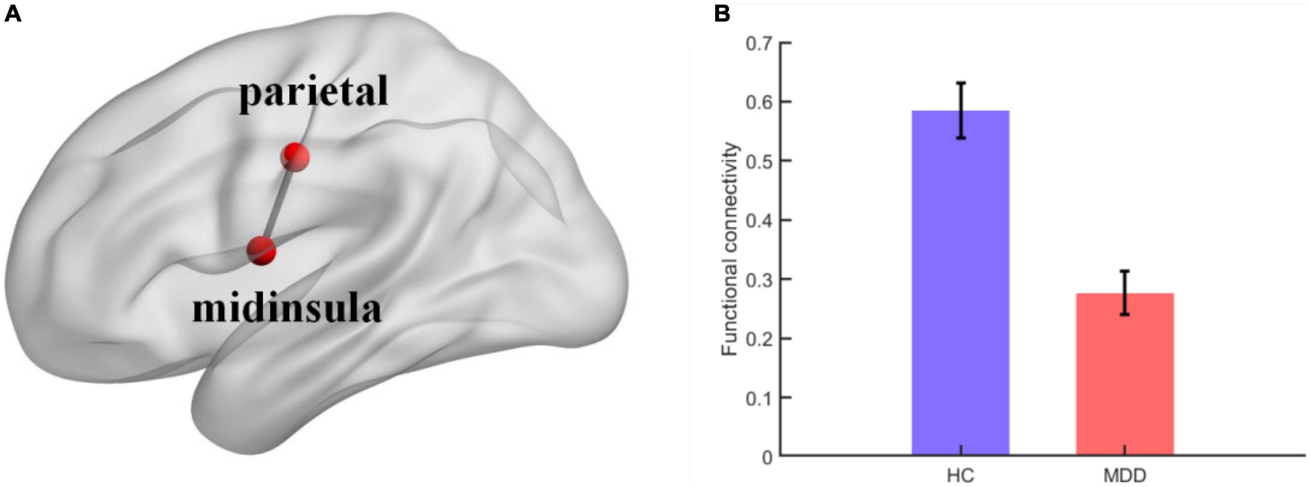 Frontiers  Neural activity in adults with major depressive disorder  differs from that in healthy individuals: A resting-state functional  magnetic resonance imaging study