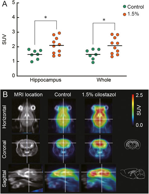 Frontiers | Reversal of spatial memory impairment by phosphodiesterase 3  inhibitor cilostazol is associated with reduced neuroinflammation and  increased cerebral glucose uptake in aged male mice