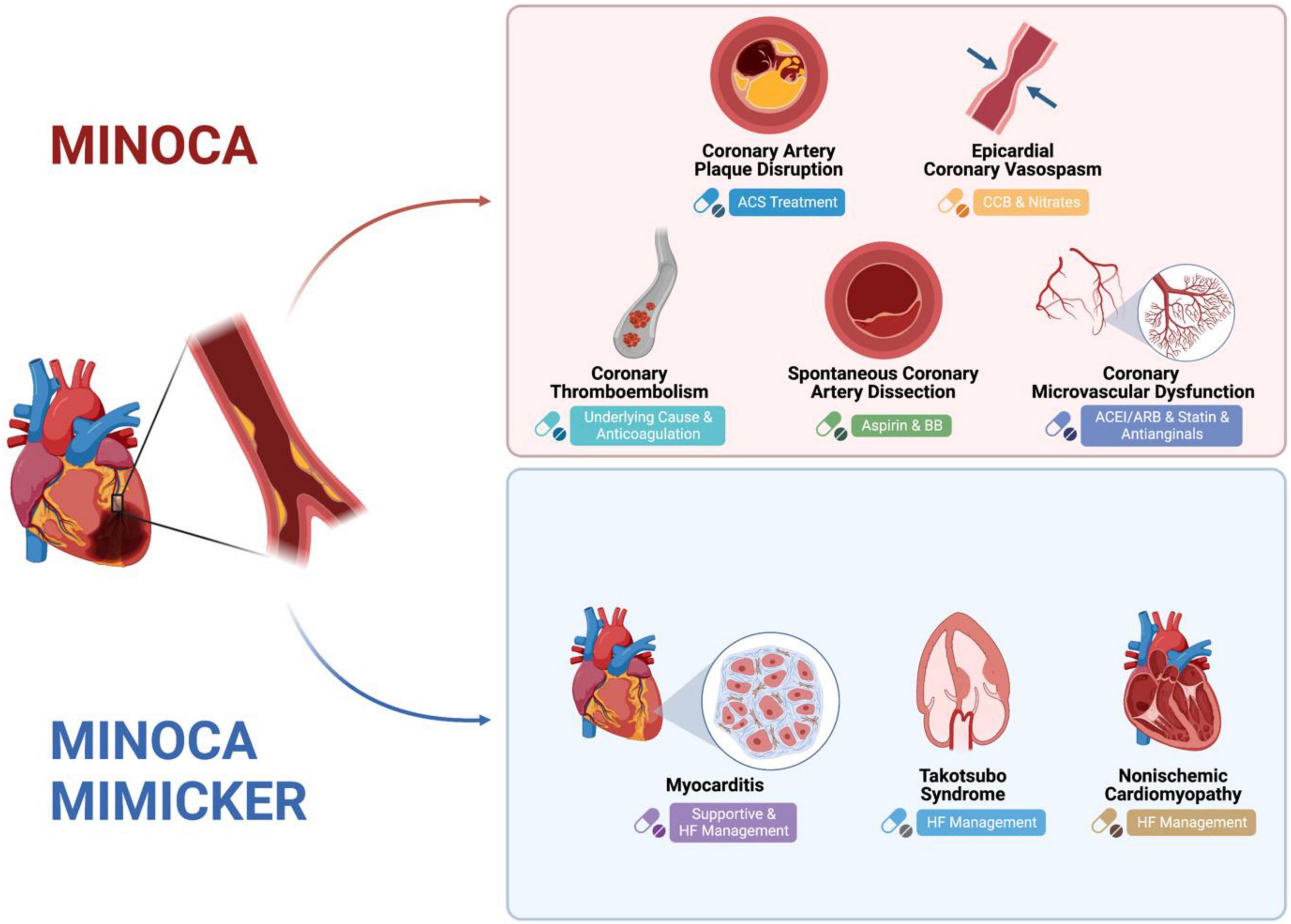 Navigating the Hurdles in Heart Attack Testing: The Key to Preventing Sudden  Death - Cardio Diagnostics