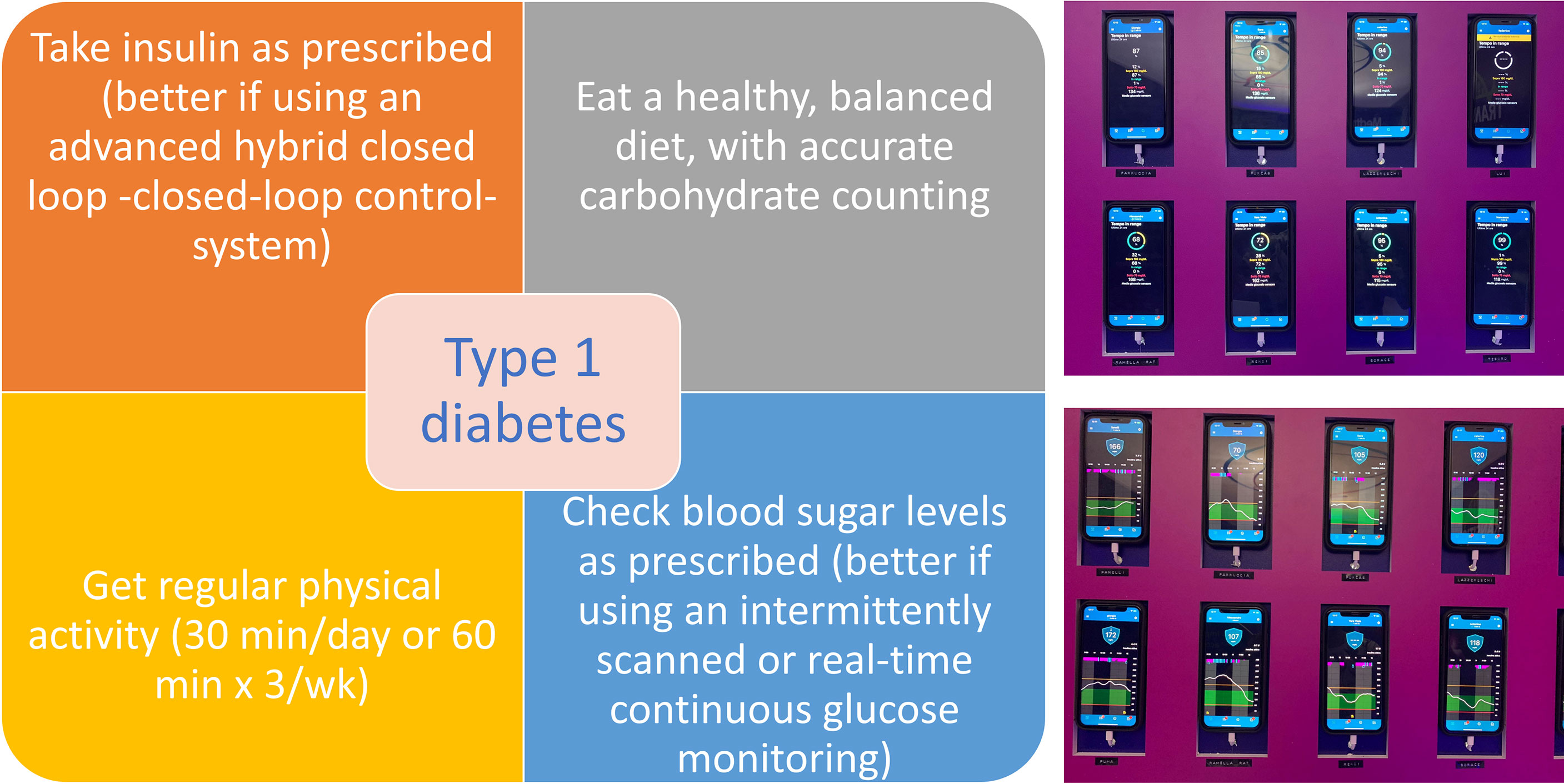 Type 1 diabetes glycemic management: Insulin therapy, glucose