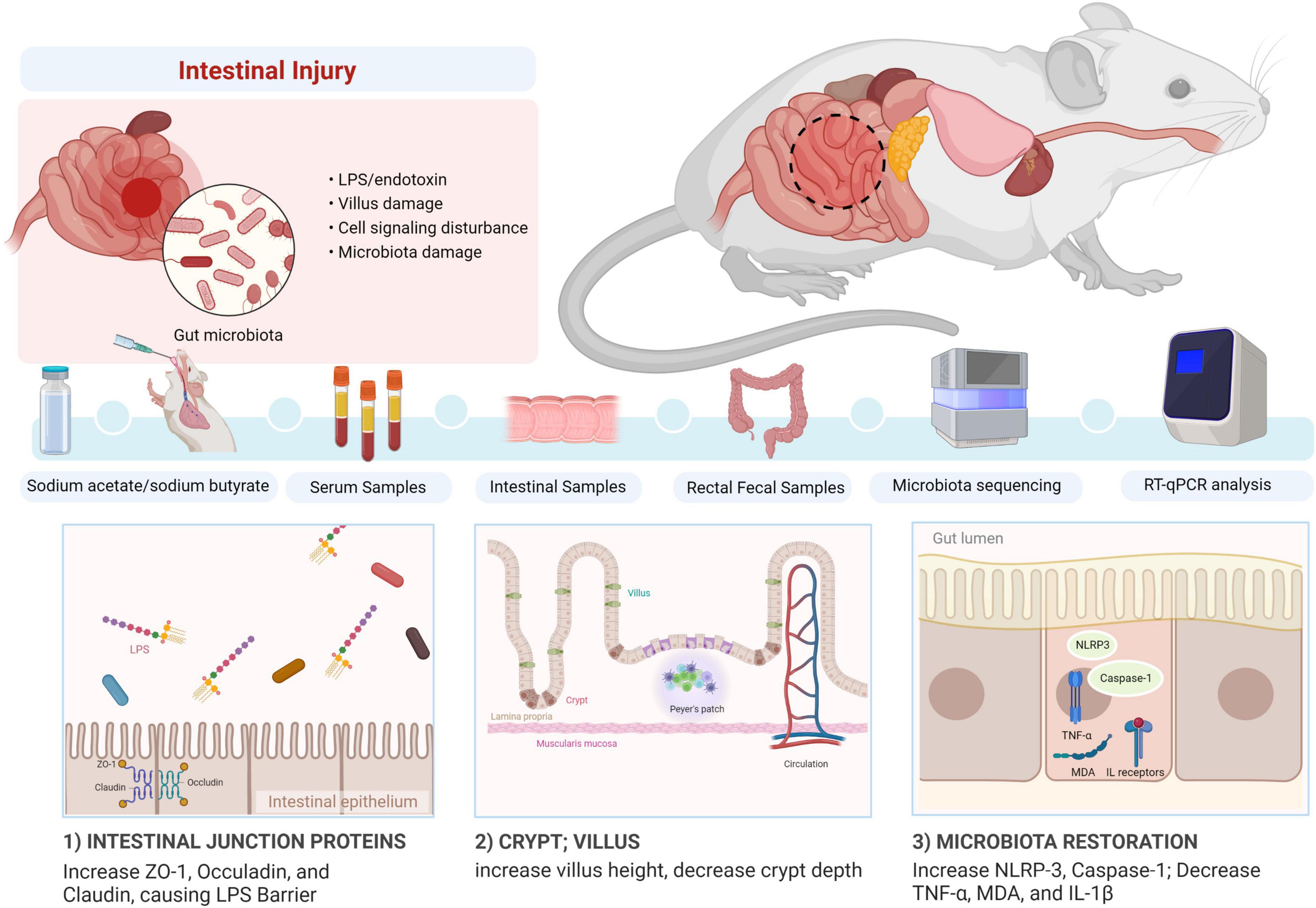 Sodium butyrate alleviates R97-116 peptide-induced myasthenia