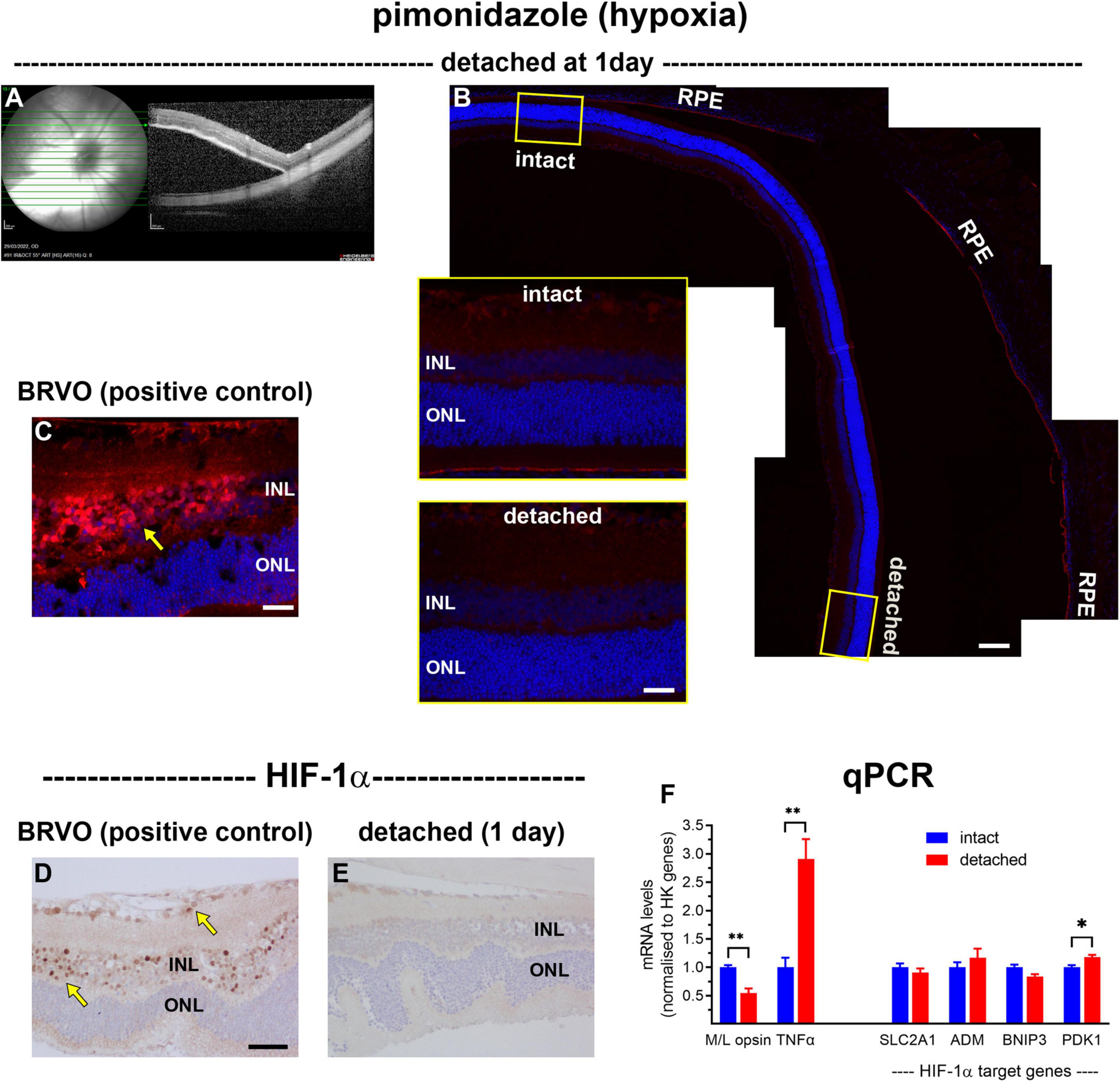 Frontiers  Investigations into photoreceptor energy metabolism during  experimental retinal detachment