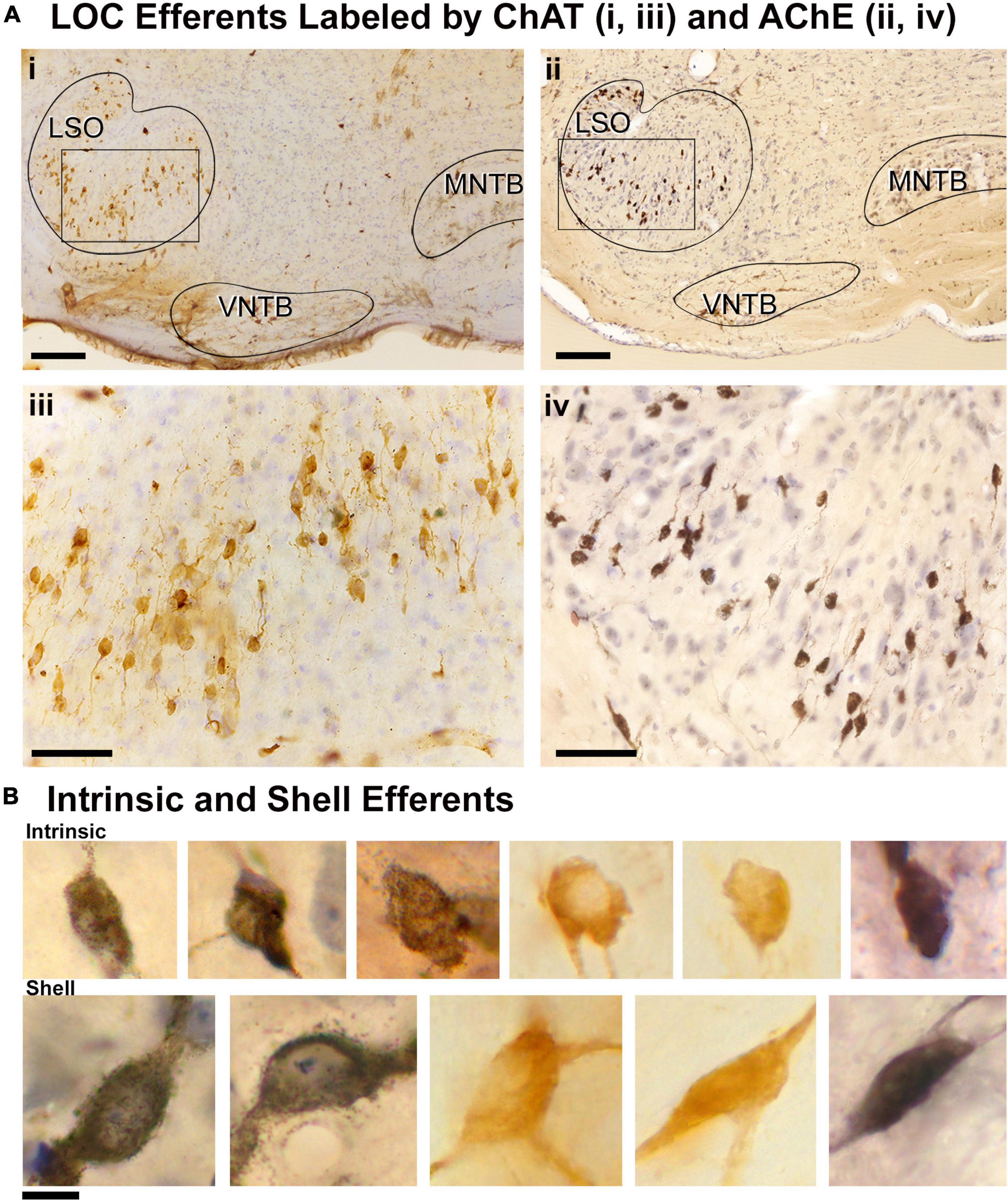 Frontiers The Lateral Superior Olive In The Mouse Two Systems Of Projecting Neurons