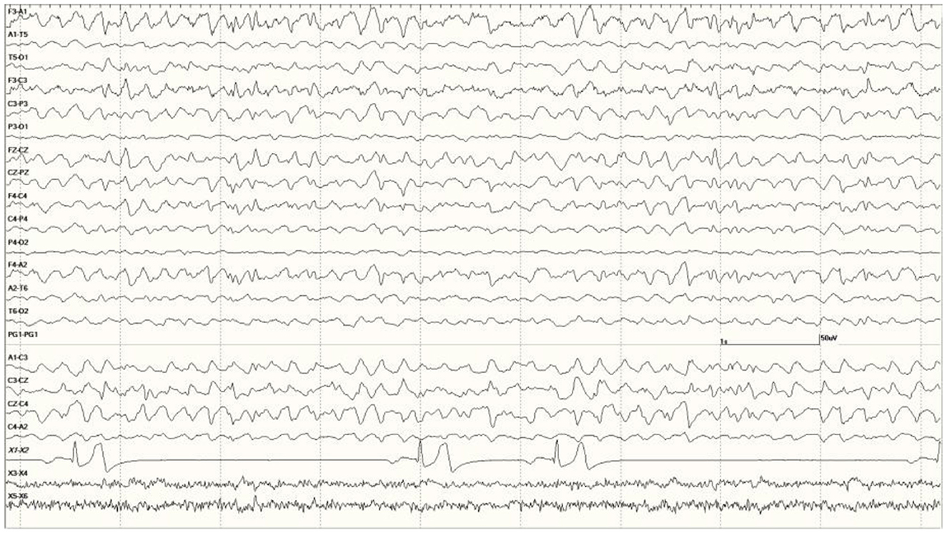 Frontiers | Pinniped electroencephalography: Methodology and findings ...