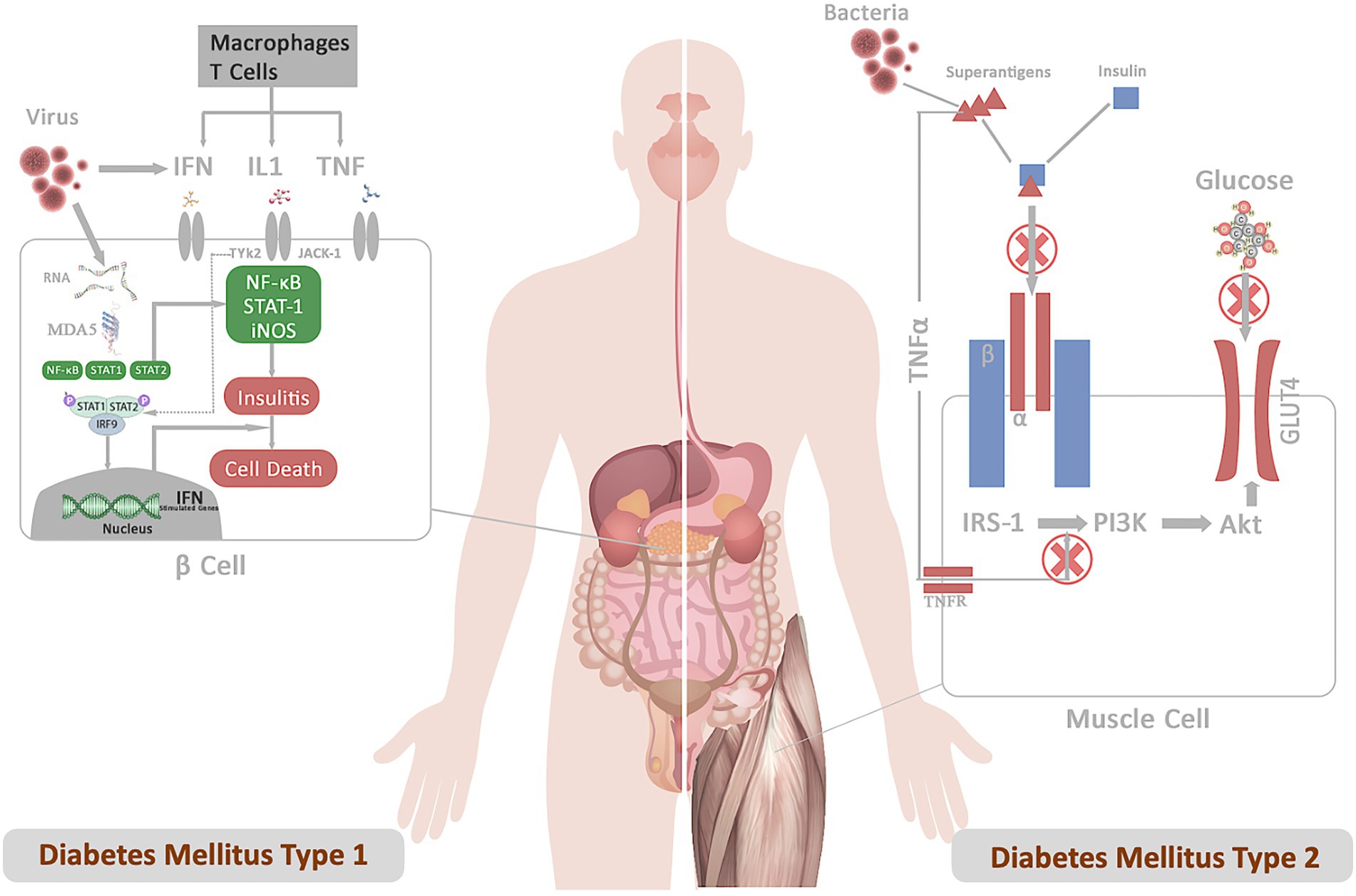 Hyperglycemia in Diabetic Skin Infections Promotes Staphylococcus aureus  Virulence Factor Aureolysin: Visualization by Molecular Imaging