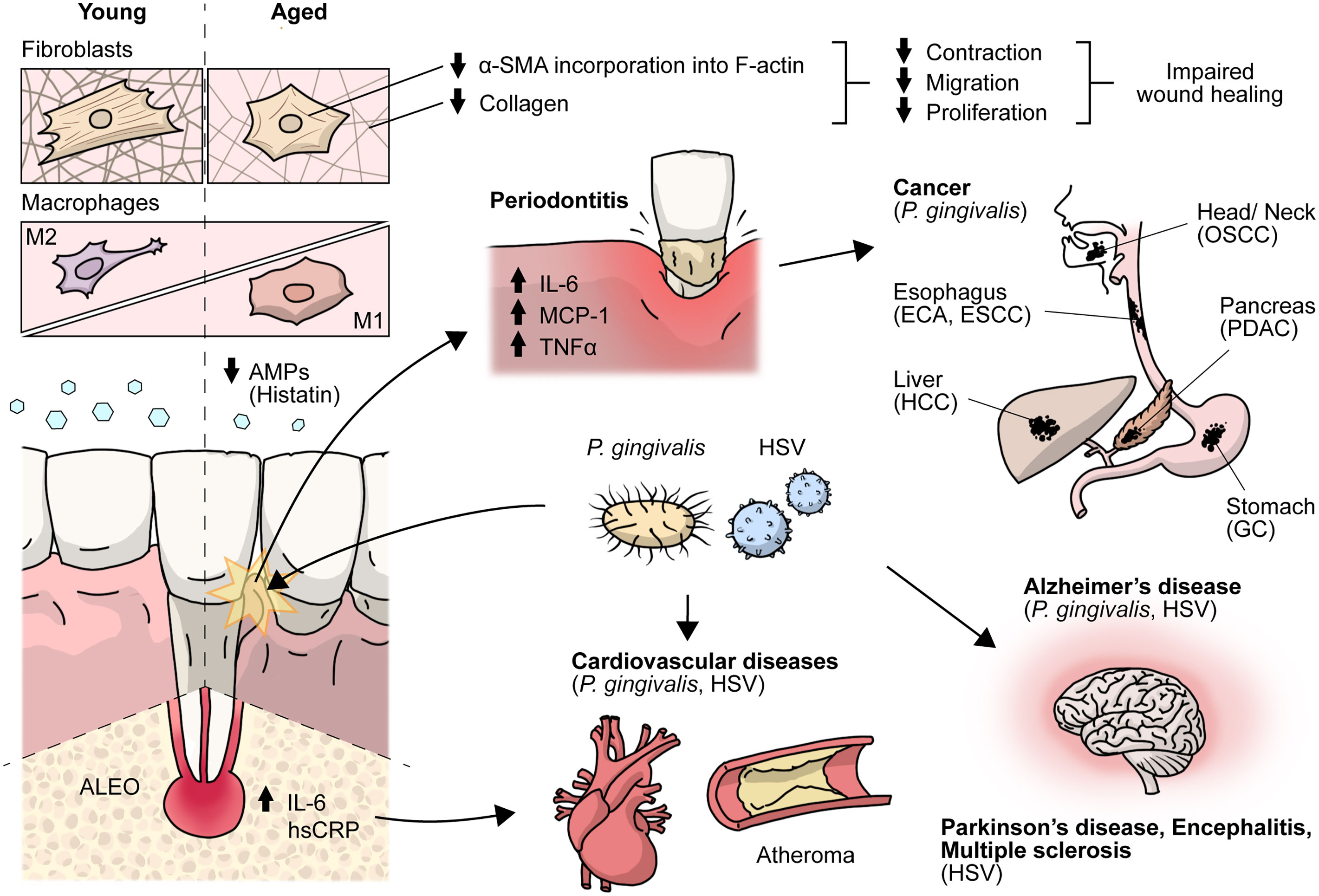 Frontiers Aging Envisage Imbalance Of The Periodontium A Keystone In 
