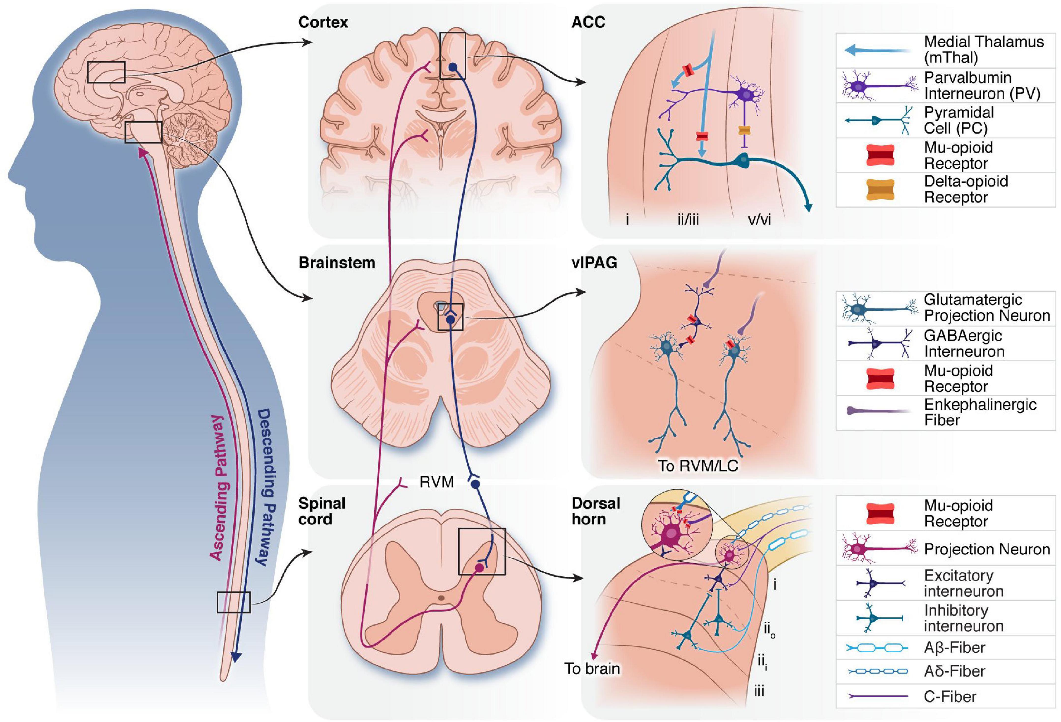 Spinal-Cord Stimulators - Even Worse Than Opioids?