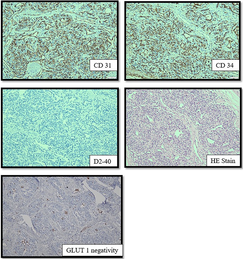 fsurg-10-1045285-g003.jpg