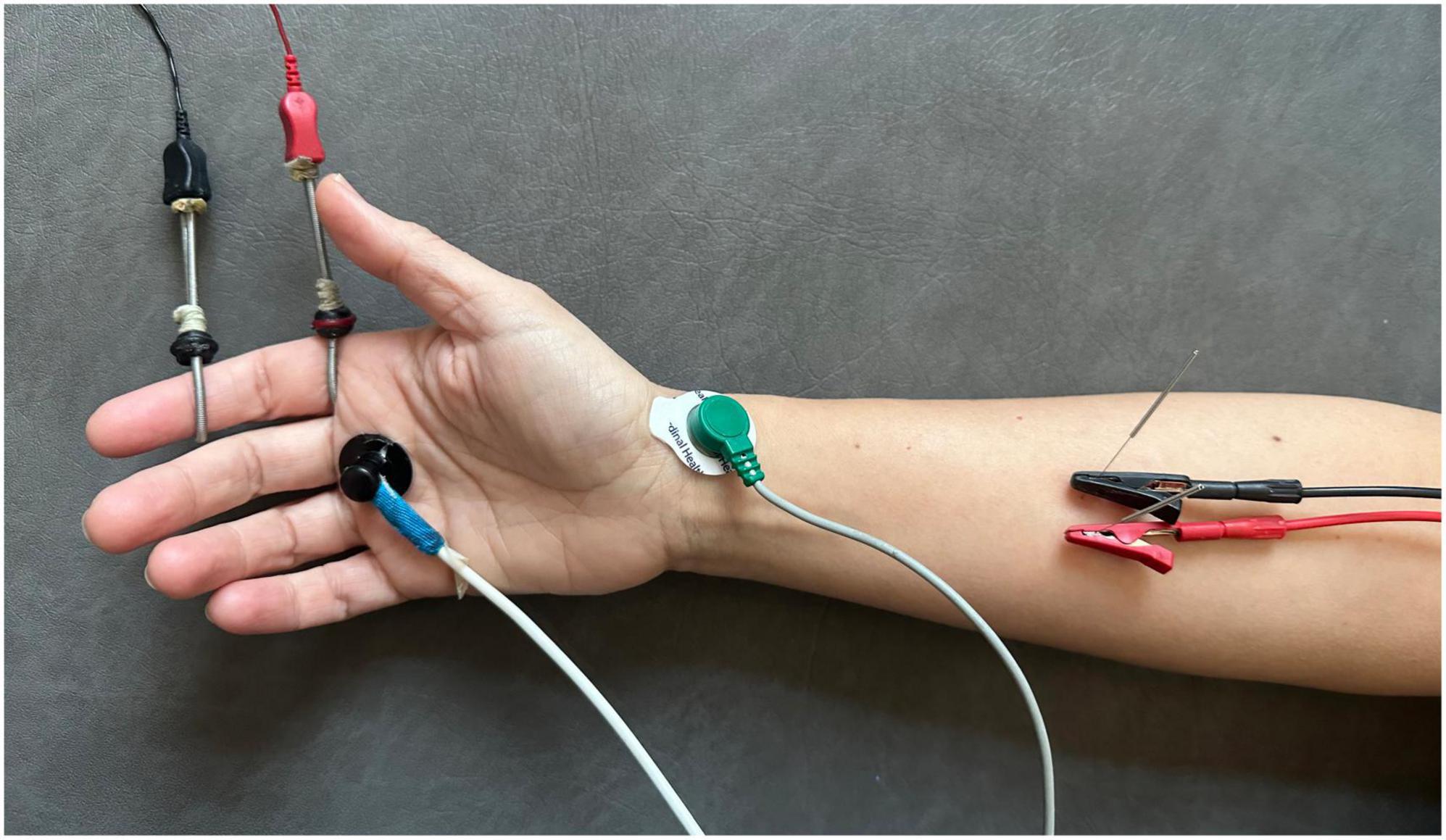 Electrical Stimulation: A Panacea for Disease? - IEEE Pulse