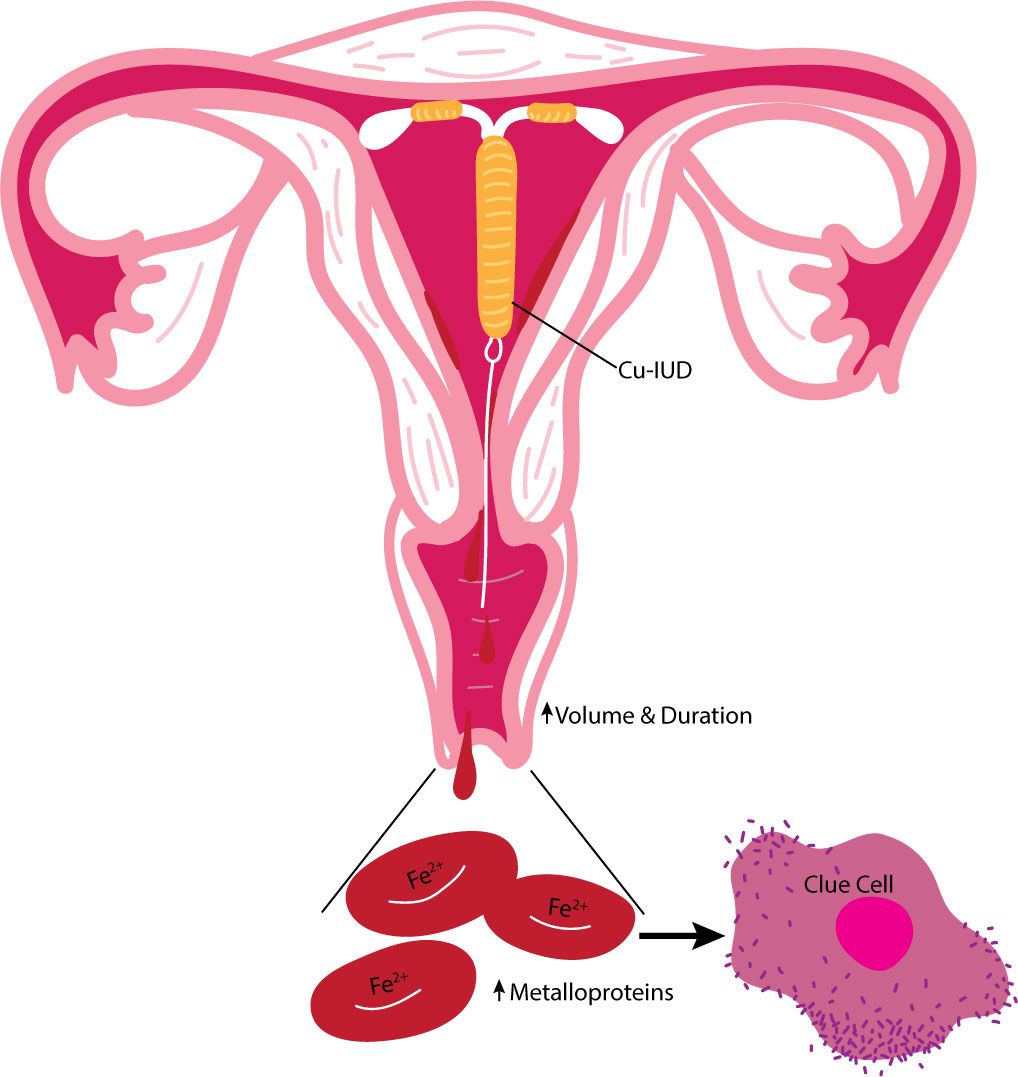 Birth Control Sponge: Effectiveness, & How It Works