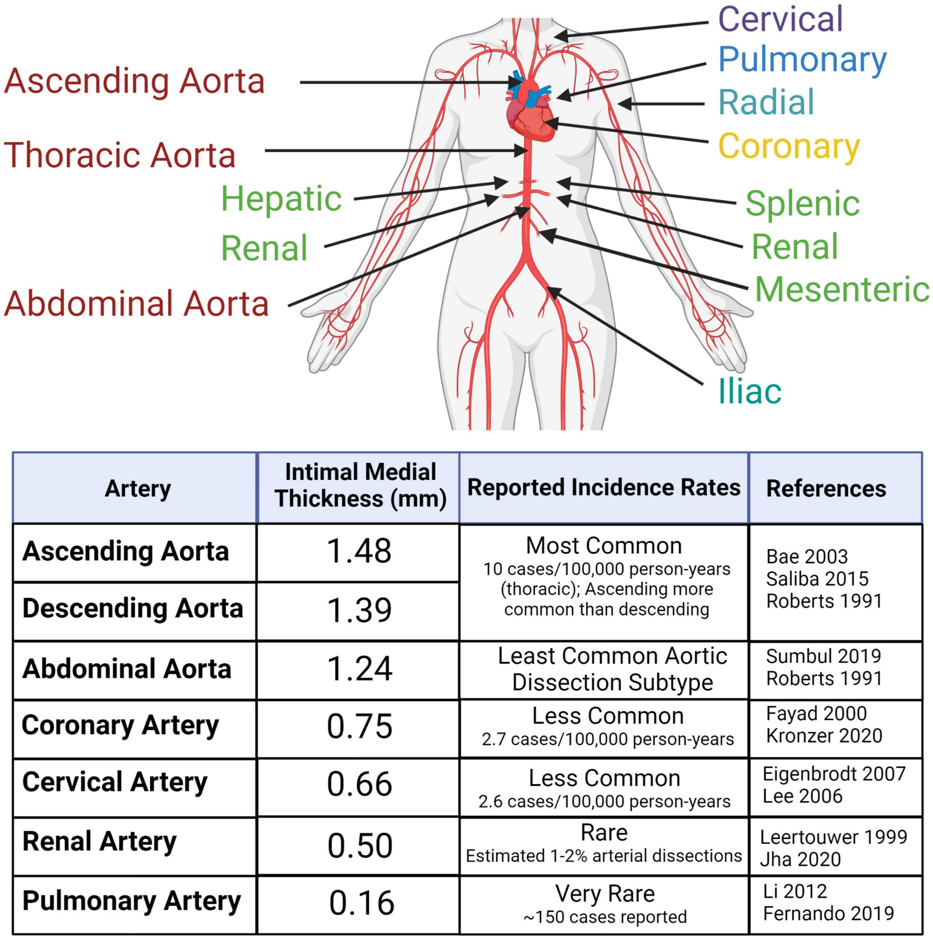 Increased Collagen Turnover Is a Feature of Fibromuscular