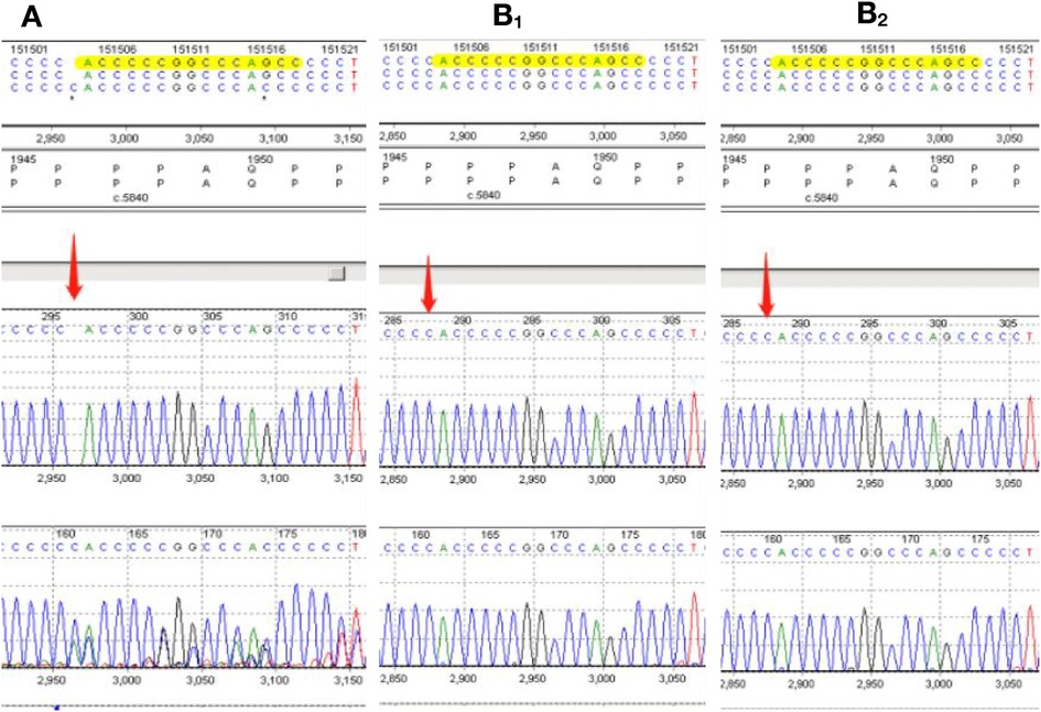 First case of Rubinstein–Taybi syndrome with desquamation associated with a  novel mutation in the bromodomain of the CREBBP gene - Wang - 2019 -  Clinical and Experimental Dermatology - Wiley Online Library