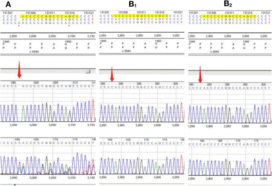 Frontiers  Case report: A preterm infant with rubinstein-taybi