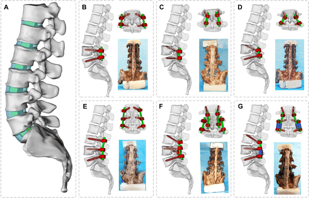 Full body marker set in (A) anterior (B) right lateral (C